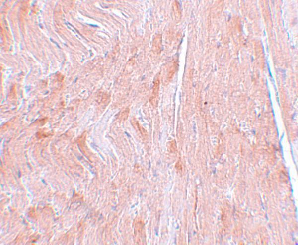 a12243 reep3 primary antibodies ihc testing 2