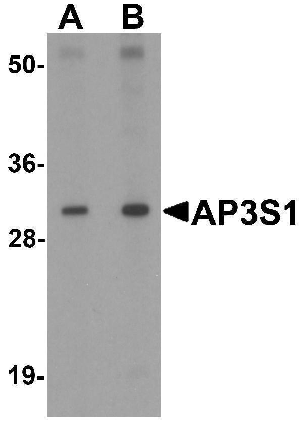 Western blot analysis of AP3S1 in mouse kidney tissue lysate with AP3S1 antibody at (A) 1 and (B) 2 μg/mL 