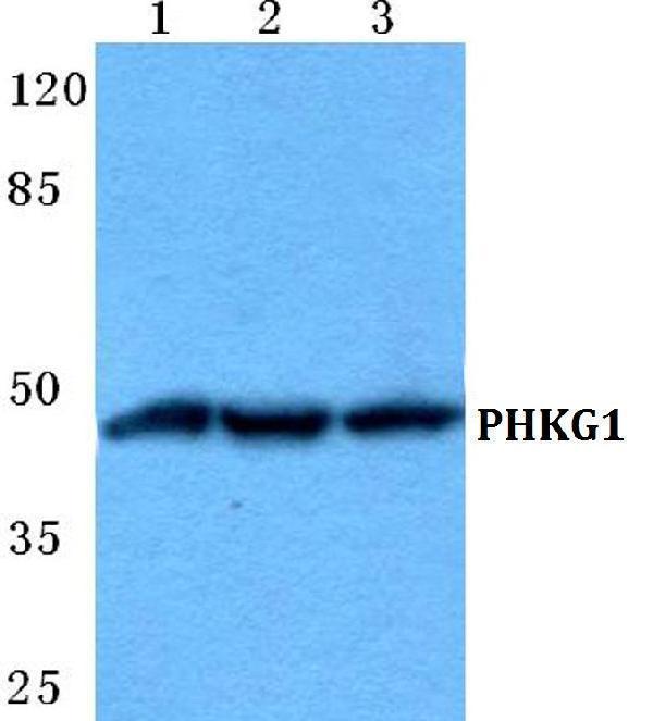 a12257 1 phkg1 primary antiboties wb testing 1