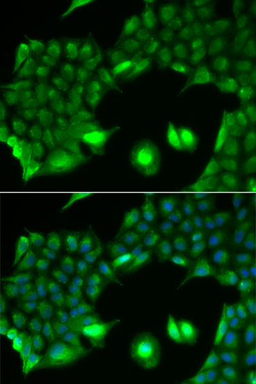 Immunofluorescence analysis of HeLa cell using SSX2 antibody