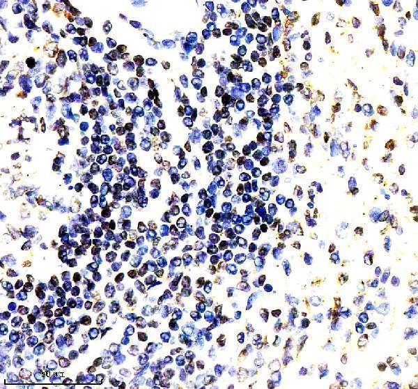 IHC analysis of PARP15 using anti-PARP15 antibody (A12266-1)