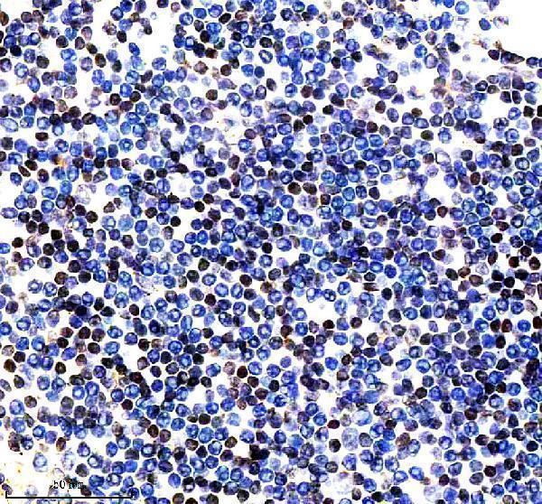 IHC analysis of PARP15 using anti-PARP15 antibody (A12266-1)