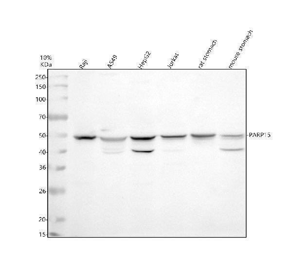 Western blot analysis of PARP15 using anti-PARP15 antibody (A12266-1)