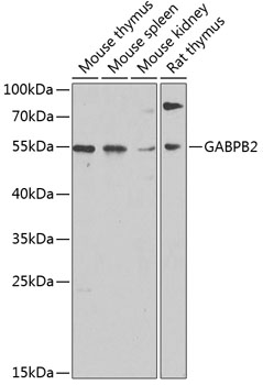 Western blot analysis of extracts of various cell lines, using GABPB2 antibody  at 1:1000 dilution