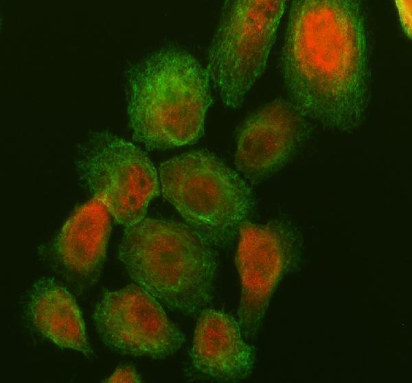 a12277 1 ddi2 primary antibodies if testing 1