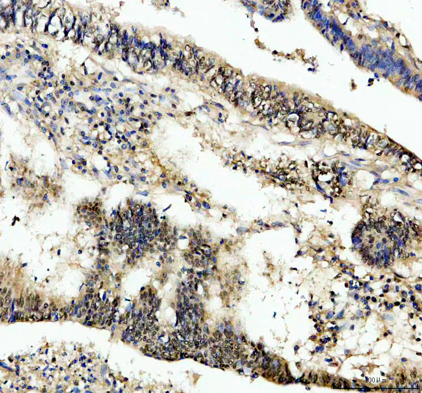 a12277 1 ddi2 primary antibodies ihc testing 2