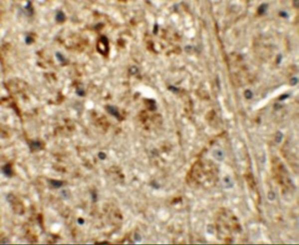 a12278 ormdl1 primary antibodies ihc testing 2