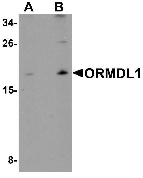 a12278 ormdl1 primary antibodies wb testing 1