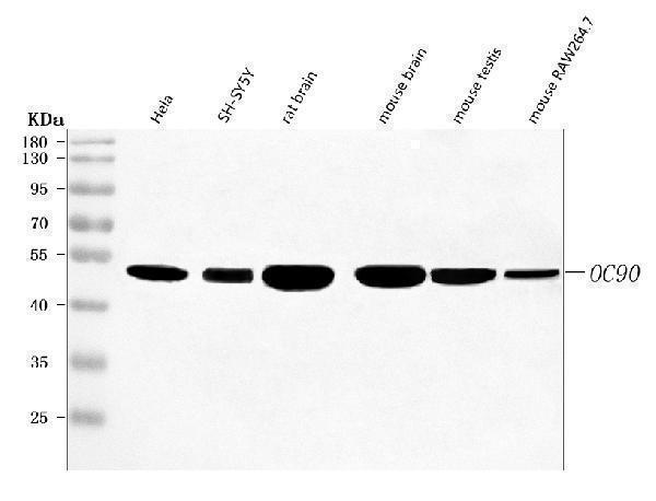  Western blot analysis of OC90 using anti-OC90 antibody (A12282-1)