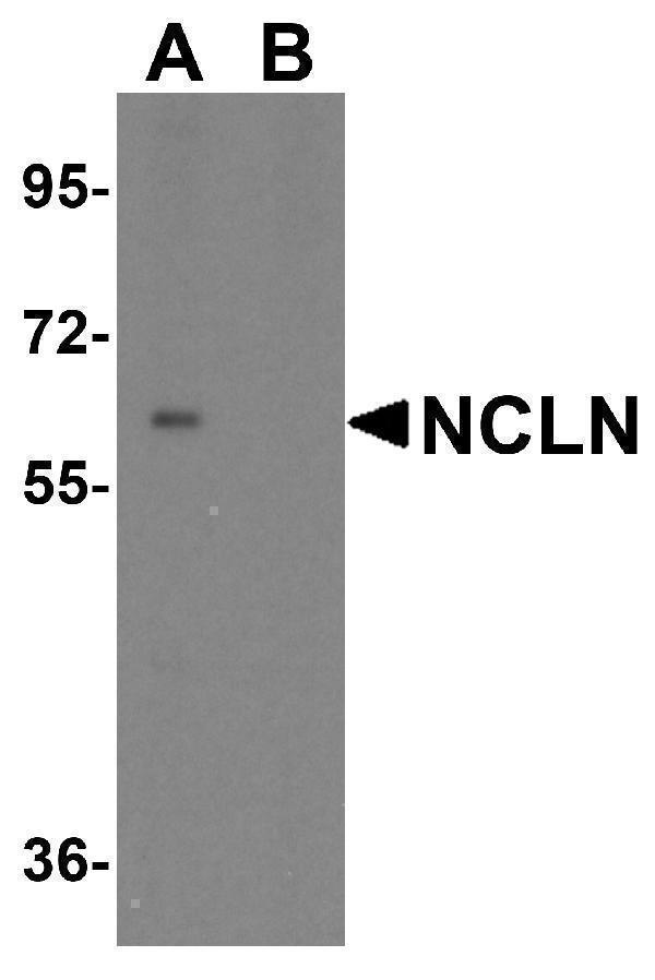 a12284 1 ncln primary antibodies wb testing 1