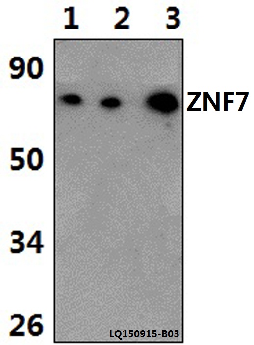 Western blot (WB) analysis of ZNF7 polyclonal antibody at 1:500 dilution
Lane1:Hela whole cell lysate(40ug)
Lane2:H9C2 whole cell lysate(40ug)
Lane3:NIH-3T3 whole cell lysate(40ug)