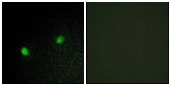 Immunofluorescence analysis of HeLa cells, using ZNF7 Antibody