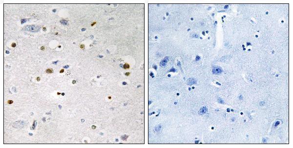 Immunohistochemistry analysis of paraffin-embedded human brain tissue, using ZNF7 Antibody