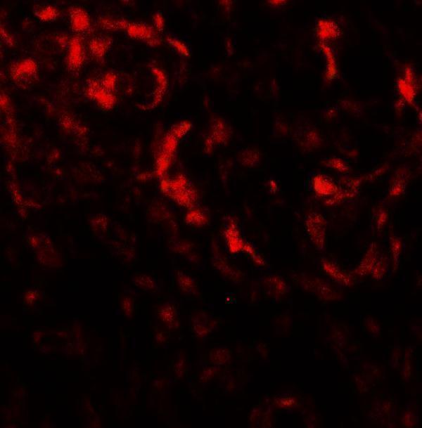 a12290 becn1p1 primary antibodies if testing 3