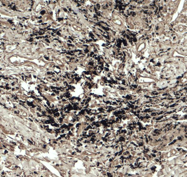 a12290 becn1p1 primary antibodies ihc testing 2