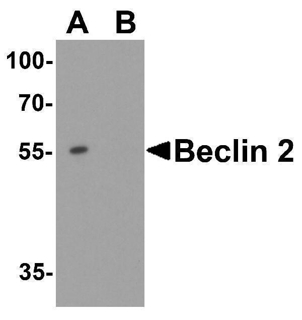 a12290 becn1p1 primary antibodies wb testing 1
