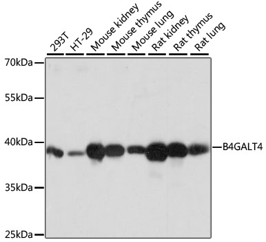 Western blot analysis of extracts of various cell lines, using B4GALT4 antibody  at 1:1000 dilution