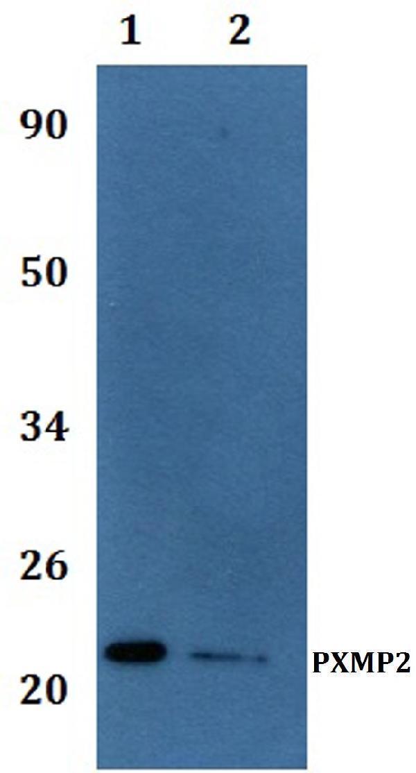 Western blot (WB) analysis of PXMP2 polyclonal antibody at 1:500 dilution 
Line1:A549 whole cell lysate
Line2:PC12 whole cell lysate
