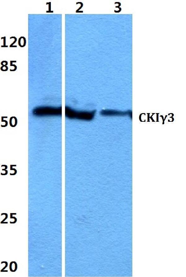 Western blot (WB) analysis of Casein Kinase Iγ3 polyclonal antibody at 1:500 dilution
Lane1:Hela cell lysate 
Lane2:sp2/0 cell lysate
Lane3:PC12 cell lysate