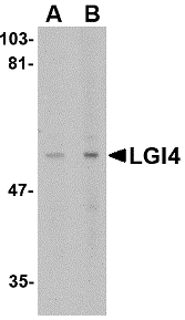 a12305 lgi4 primary antibodies wb testing 1