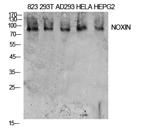 Western Blot (WB) analysis of 823, 293T, AD293, HeLa, HepG2 cells using NOXIN Polyclonal antibody