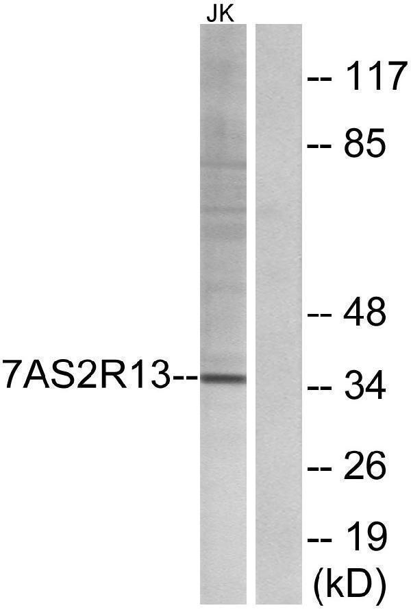 a12309 tas2r13 primary antibodies wb testing 3