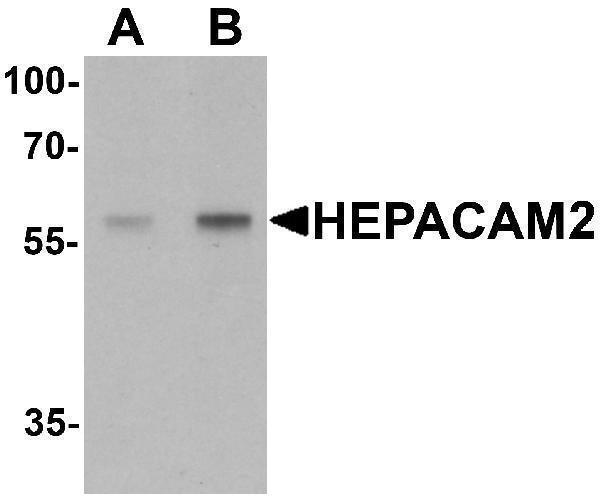 Western blot analysis of HEPACAM2 in mouse brain tissue lysate with HEPACAM2 antibody at (A) 0