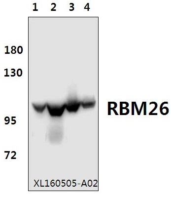 Western blot (WB) analysis of RBM26 polyclonal antibody at 1:500 dilution
Lane1:Hela whole cell lysate(40ug)
Lane2:HEK293T whole cell lysate(40ug)
Lane3:H9C2 whole cell lysate(40ug)
Lane4:SP2/0 whole cell lysate(40ug)