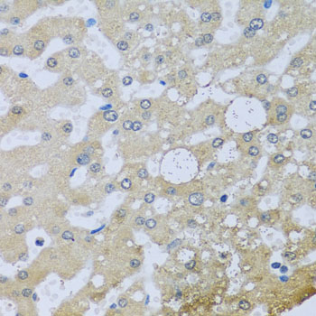 a12320 uqcr10 primary antiboties ihc testing 2