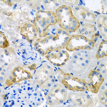 a12320 uqcr10 primary antiboties ihc testing 3