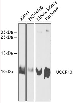 a12320 uqcr10 primary antiboties wb testing 1
