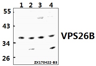 a12325 1 vps26b primary antiboties wb testing 1