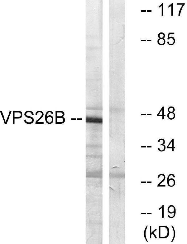 a12325 vps26b primary antibodies wb testing 1