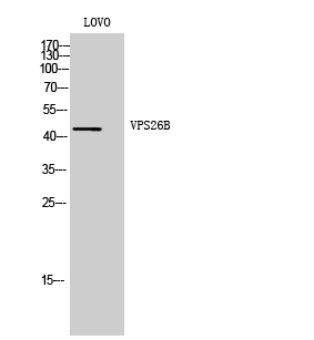 a12325 vps26b primary antibodies wb testing 2