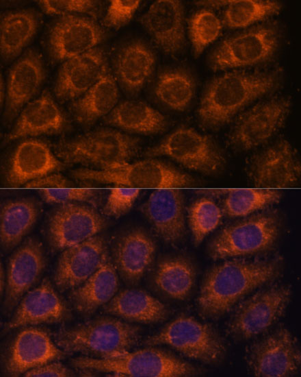 a12335 cct6b primary antiboties if testing 2