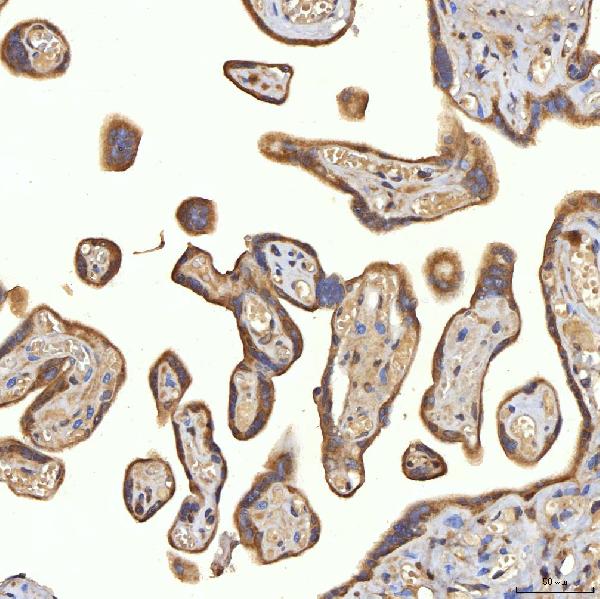 Figure 3. IHC analysis of SRPRA using anti-SRPRA antibody (A12340-1). SRPRA was detected in a paraffin-embedded section of human placenta tissue. Heat mediated antigen retrieval was performed in EDTA buffer (pH 8.0, epitope retrieval solution). The tissue section was blocked with 10% goat serum. The tissue section was then incubated with 2 microg/ml rabbit anti-SRPRA Antibody (A12340-1) overnight at 4°C. Peroxidase Conjugated Goat Anti-rabbit IgG was used as secondary antibody and incubated for 30 minutes at 37°C. The tissue section was developed using HRP Conjugated Rabbit IgG Super Vision Assay Kit (Catalog # SV0002) with DAB as the chromogen.