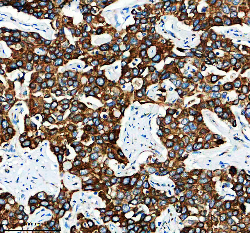 a12346 lyrm7 primary antibodies ihc testing 1