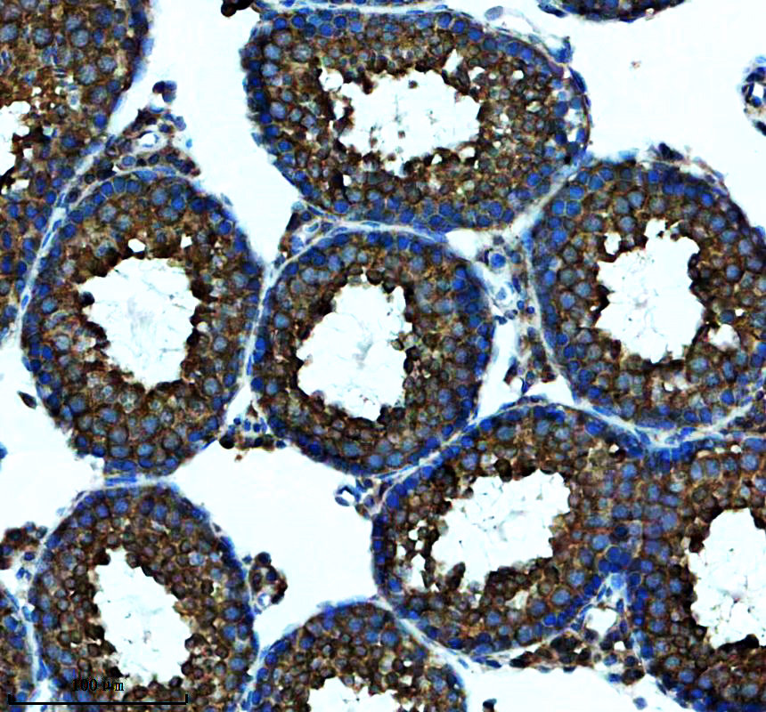 a12346 lyrm7 primary antibodies ihc testing 2