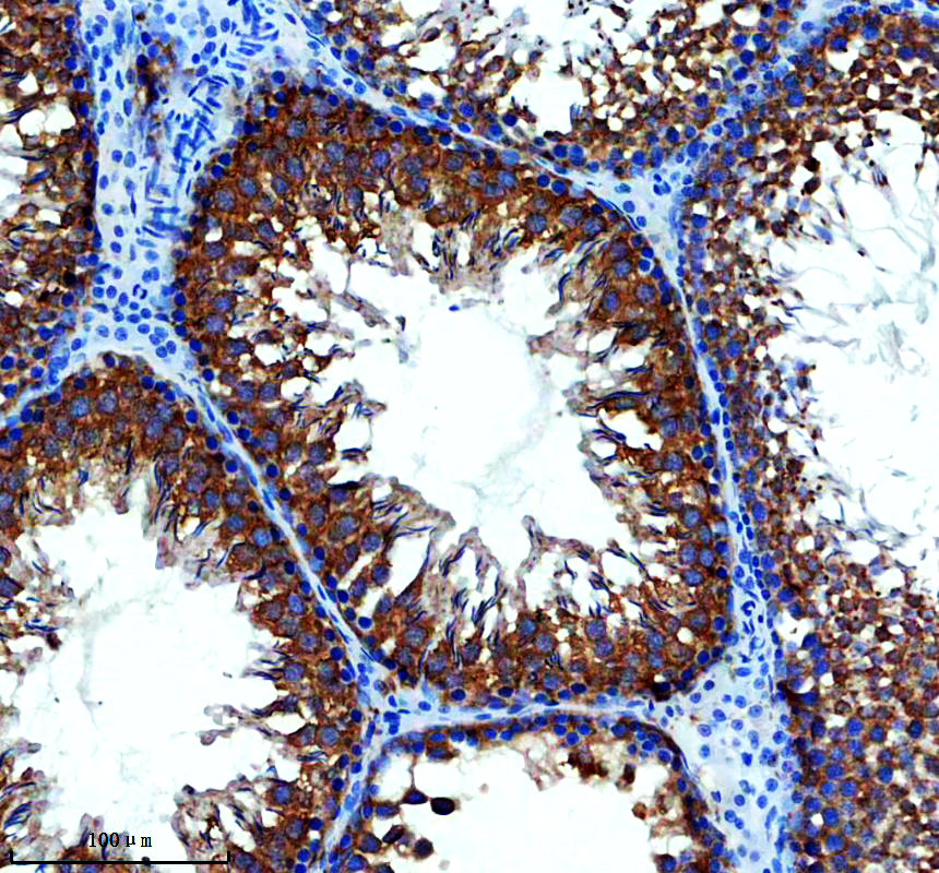 a12346 lyrm7 primary antibodies ihc testing 3