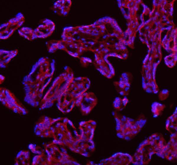 a12350 1 samd9l primary antibodies if testing 16