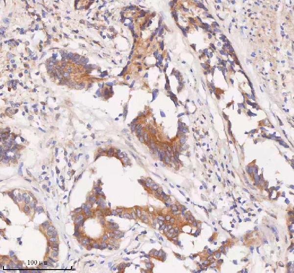a12350 1 samd9l primary antibodies ihc testing 11