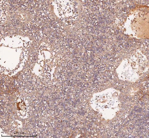 a12350 1 samd9l primary antibodies ihc testing 12