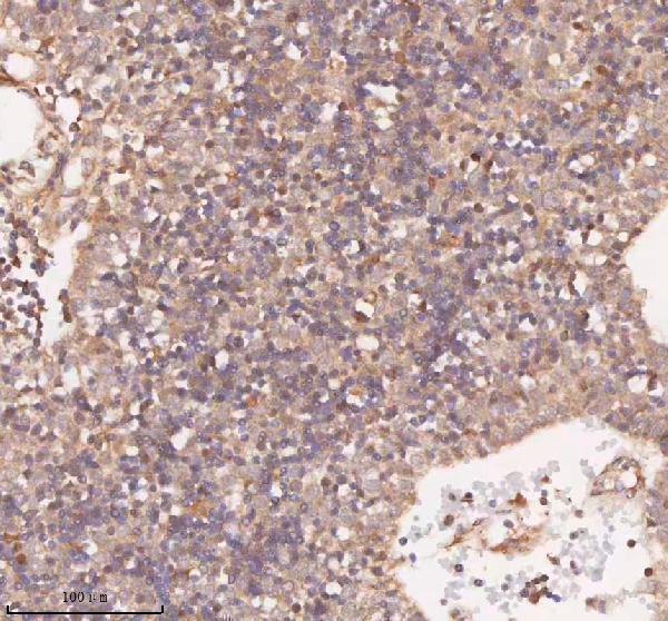 a12350 1 samd9l primary antibodies ihc testing 13
