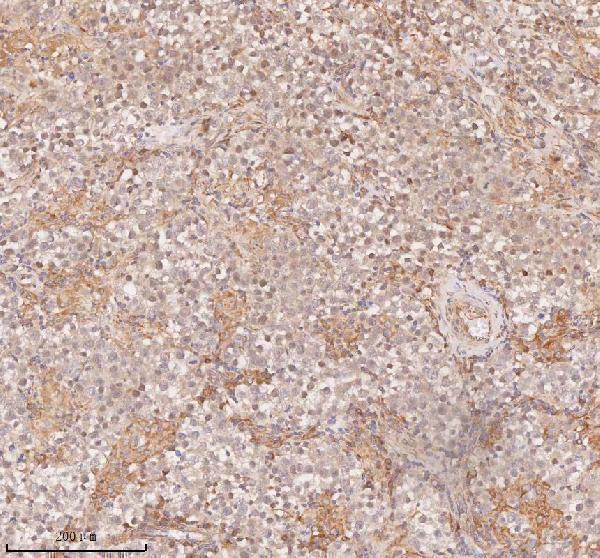 a12350 1 samd9l primary antibodies ihc testing 14