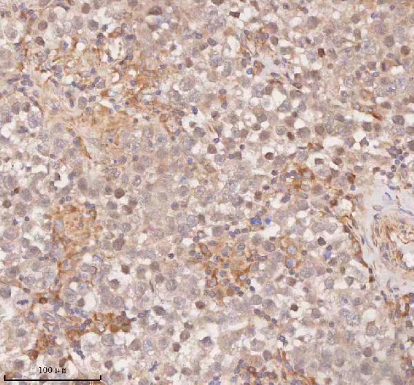 a12350 1 samd9l primary antibodies ihc testing 15