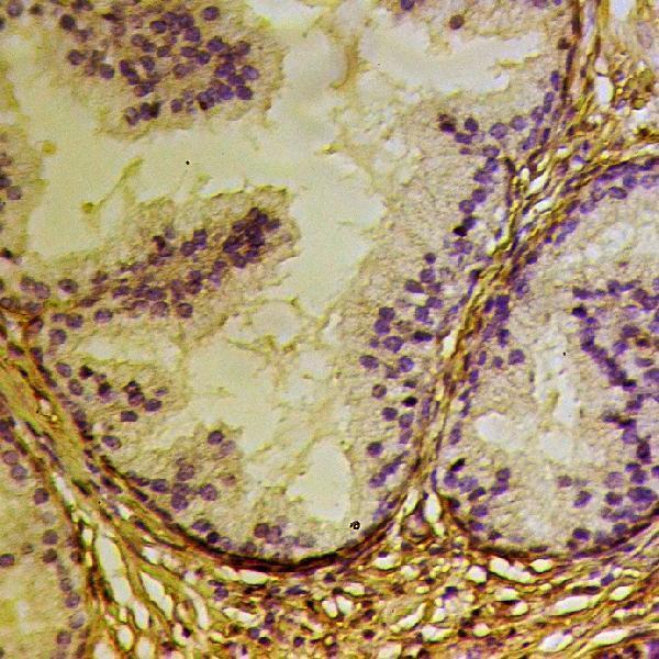 Immunohistochemistry (IHC) analyzes of GJC3 polyclonal antibody in paraffin-embedded human prostate tissue at 1:50
