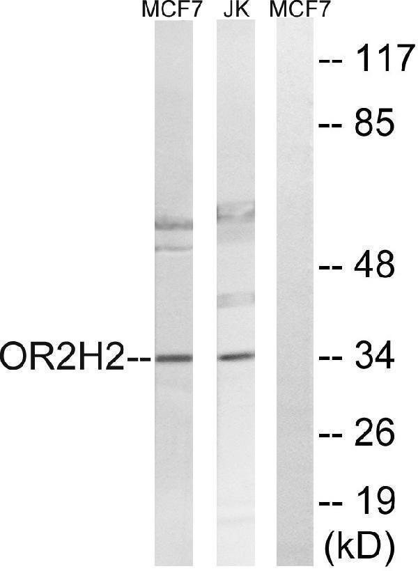 Western blot analysis of lysates from Jurkat and MCF-7 cells, using OR2H2 Antibody