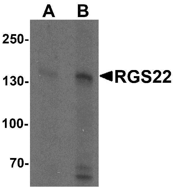 a12367 rgs22 primary antibodies wb testing 1