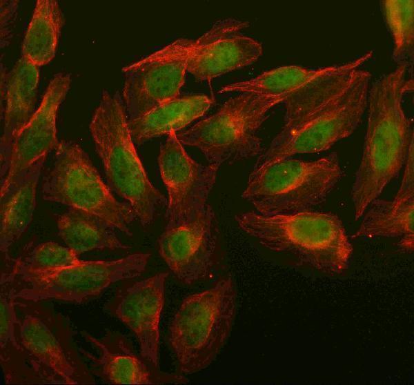  IF analysis of C6orf130/OARD1 using anti-C6orf130/OARD1 antibody (A12369) and anti-Beta Tubulin antibody (M01857-3)