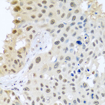 Immunofluorescence analysis of U2OS cells using DNAL1 antibody  at dilution of 1:100